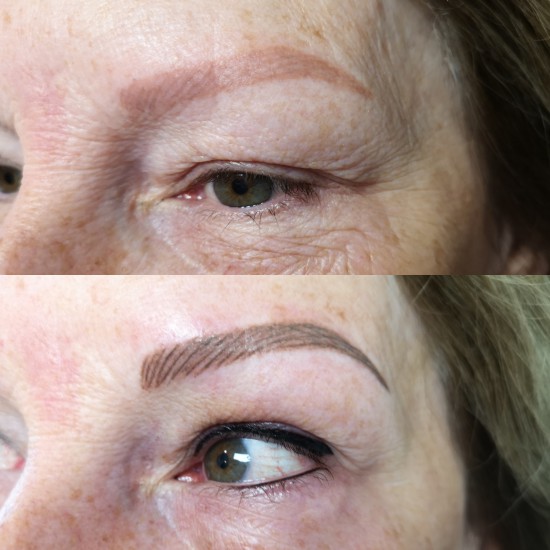 rode rest oude PMU elders gezet dermaplus rode rest oude PMU elders gezet dermaplus