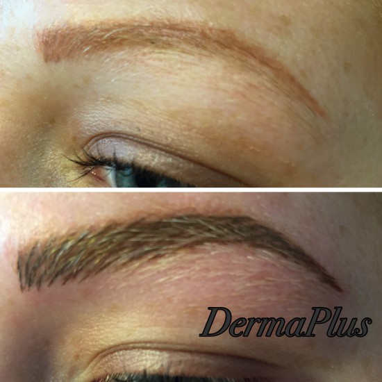 Herstel PMU 2 dermaplus Herstel PMU 2 dermaplus