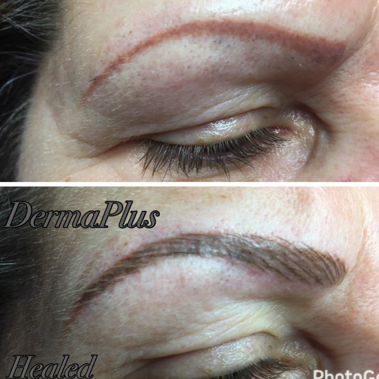 Herstel PMU 3 Dermaplus Herstel PMU 3 Dermaplus