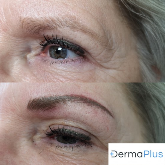 Hairstrokes en Shade bij Dermaplus Hairstrokes en Shade bij Dermaplus