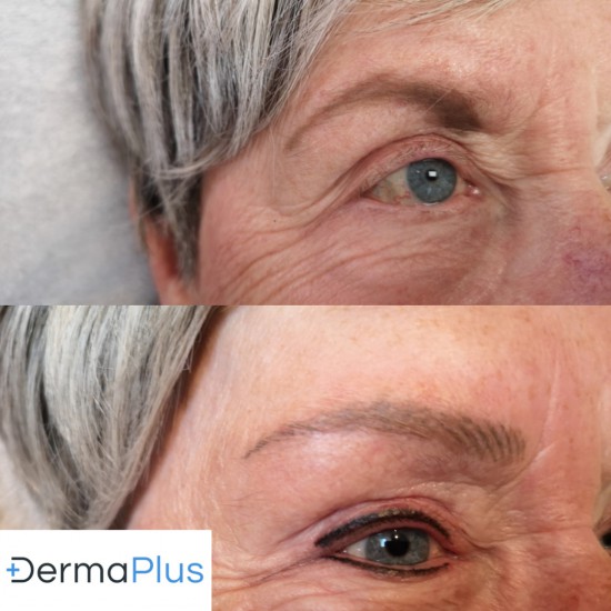 luchtige hairstroke Dermaplus luchtige hairstroke Dermaplus