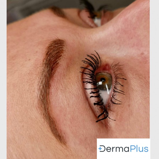 Hairstrokes Dermaplus Hairstrokes Dermaplus
