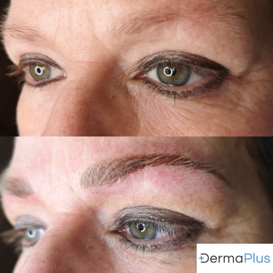 Hairstrokes en Shade bij Dermaplus Hairstrokes en Shade bij Dermaplus