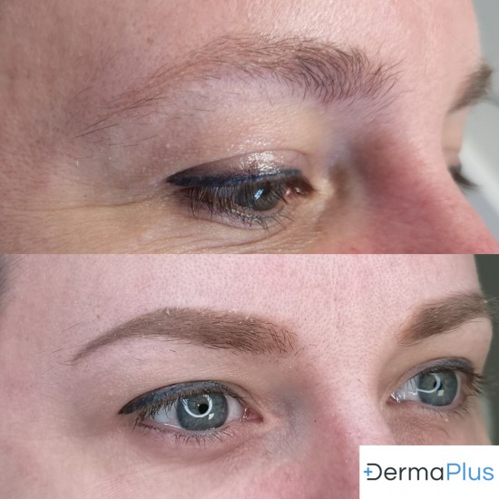 Shading of Ombre techniek Dermaplus Shading of Ombre techniek Dermaplus